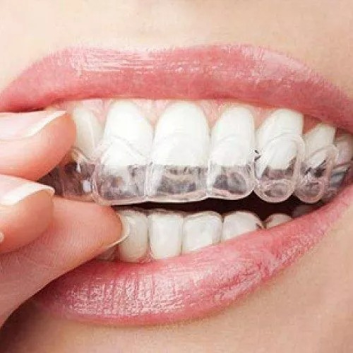 7 Things You Can Do To Take Care Of Your Invisalign